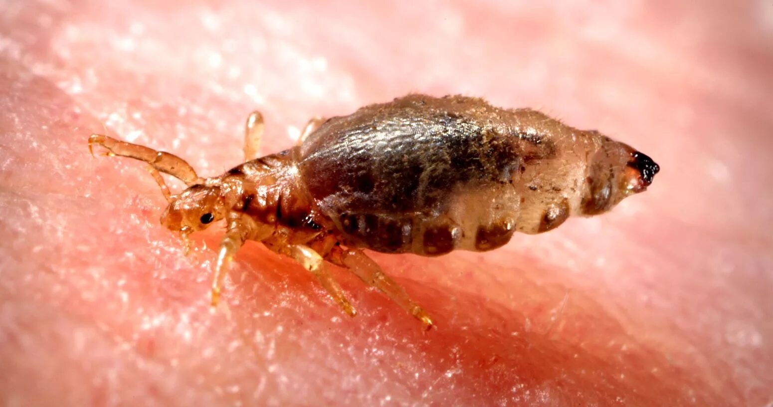 Iceberg. Нью-эйдж (new age) субкультура. Глисты энтеробиоз острицы. Черный айсберг. Як виглядають.