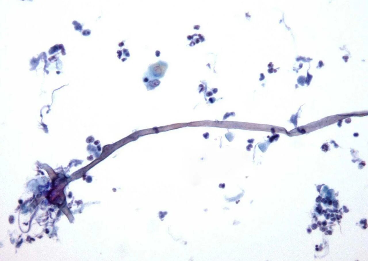 Споры candida. Грибы Candida псевдомицелий. Грибы кандида лептотрикс. Грибы Candida под микроскопом. Микроскопия кандиды псевдомицелий.