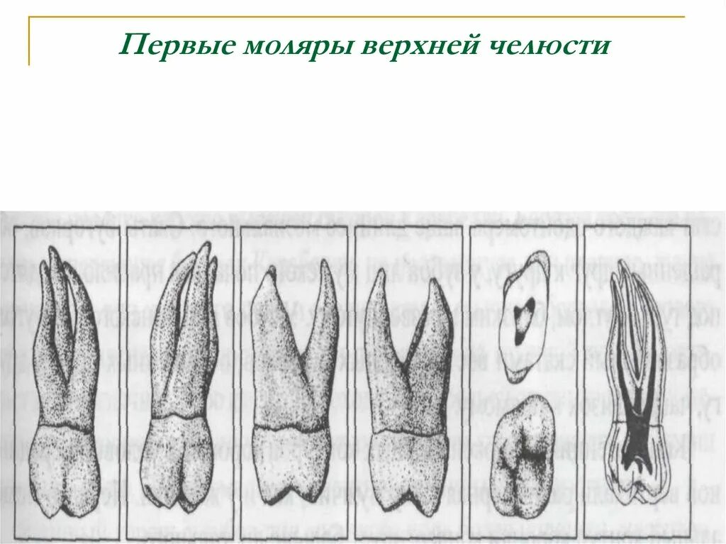 Первый моляр верхней челюсти. 1 Моляр верхней челюсти анатомия. Первый моляр верхней челюсти строение. Верхний 2 моляр верхней челюсти. 1 Моляр верхней челюсти корни.