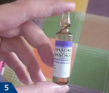 Уколы от зубной боли