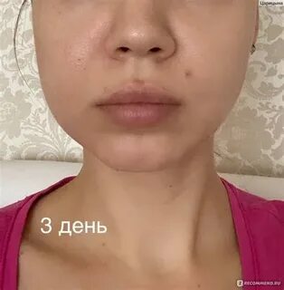 Впали щеки