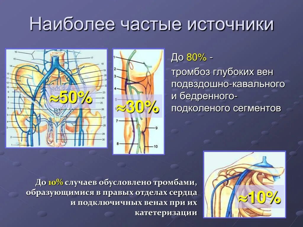 Тромбоз подключичной вены. Тромб подключичной вены. Тромб бедренной и подвздошной вены. Тромбоз подвздошной вены