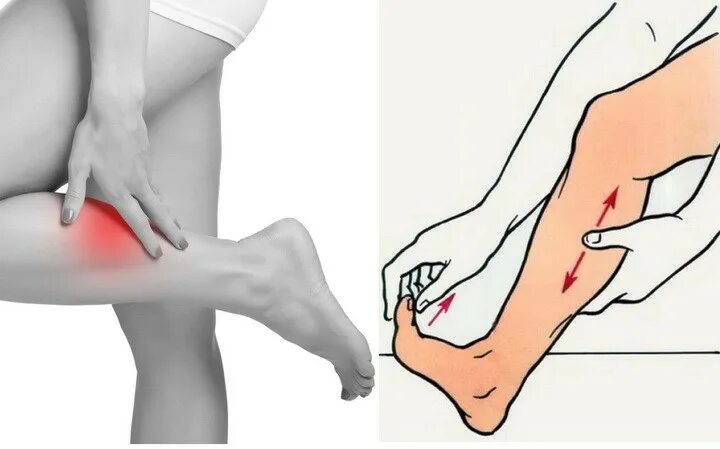 Мышечная боль в ногах причины. Судороги в ногах икроножные мышцы.