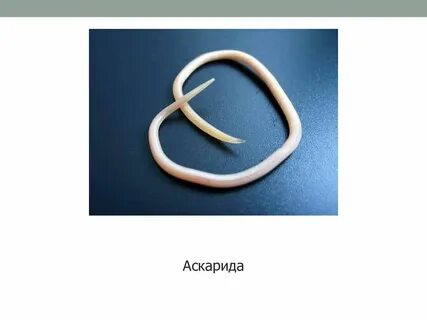 Аскариды у детей симптомы