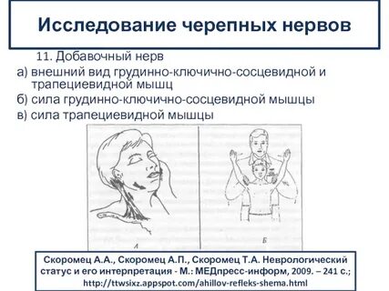 Неврология нерва