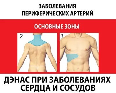 Пульсация периферических артерий