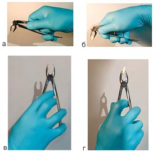 Хирургическая стоматология зубов. Зубы удалять щипцами. Способы держания стоматологических щипцов. Зубы удалять щипцами. Зубы удалять щипцами.