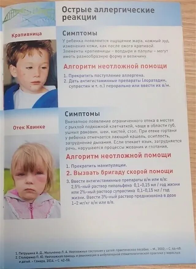 Помощь при крапивнице алгоритм. Крапивница у детей неотложная помощь. крапивница первая помощь алгоритм. крапивница первая помощь детям. неотложная помощь при крапивнице у детей.