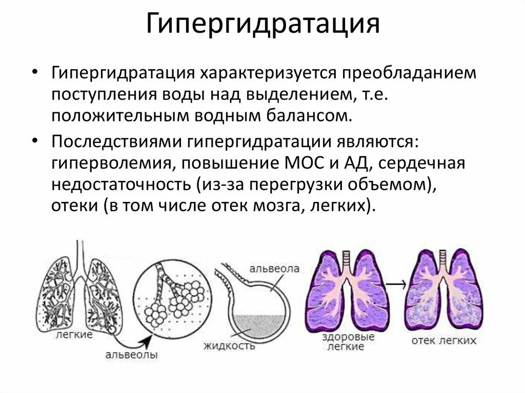 Гипергидратация. Виды гипергидратации. Внутриклеточная гипергидратация. При гипергидратации организма. Много воды в легких