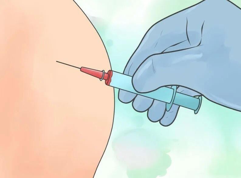 Укол. Укол в ягодицу. Внутримышечный укол. Уколоть укол внутримышечно. Укол инсулина в ягодицу.