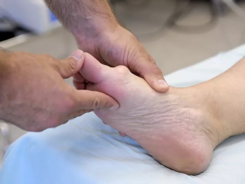 Болит большой палец на ноге чем лечить. Бурсит плюснефалангового сустава. Подошвенный фиброматоз. Бурсит вальгусной косточки.