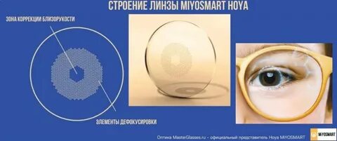Линзы miyosmart отзывы
