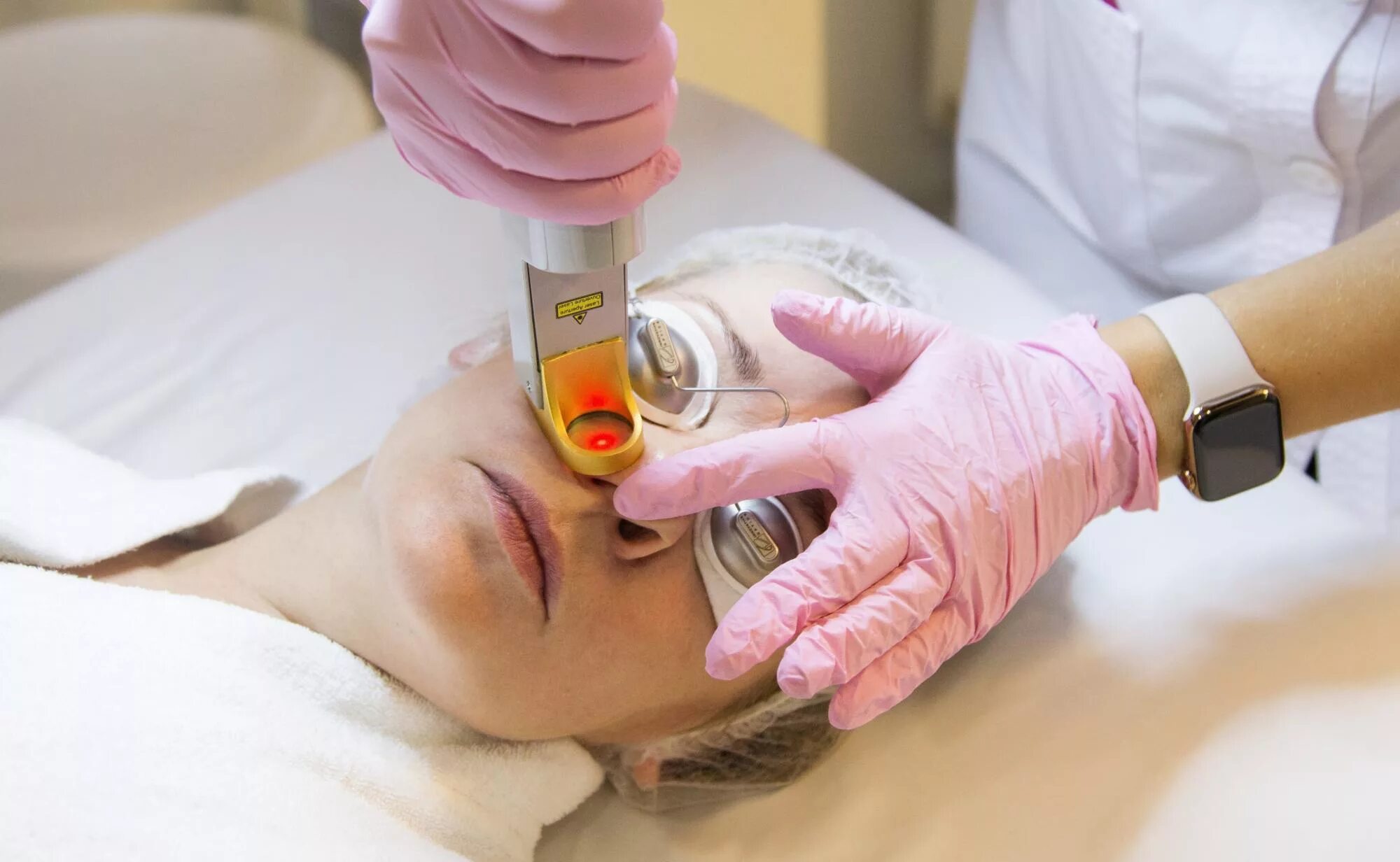 Омоложение сосудов. Лазерная коагуляция сосудов. лазерная фотокоагуляция сосудов. фотокоагуляция сосудов на лице. сосудистая терапия лица.