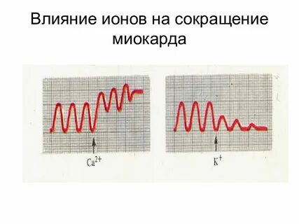 Сокращение миокарда