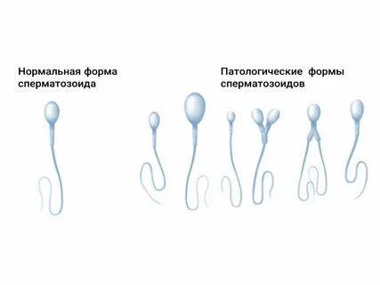 Сперможуйки