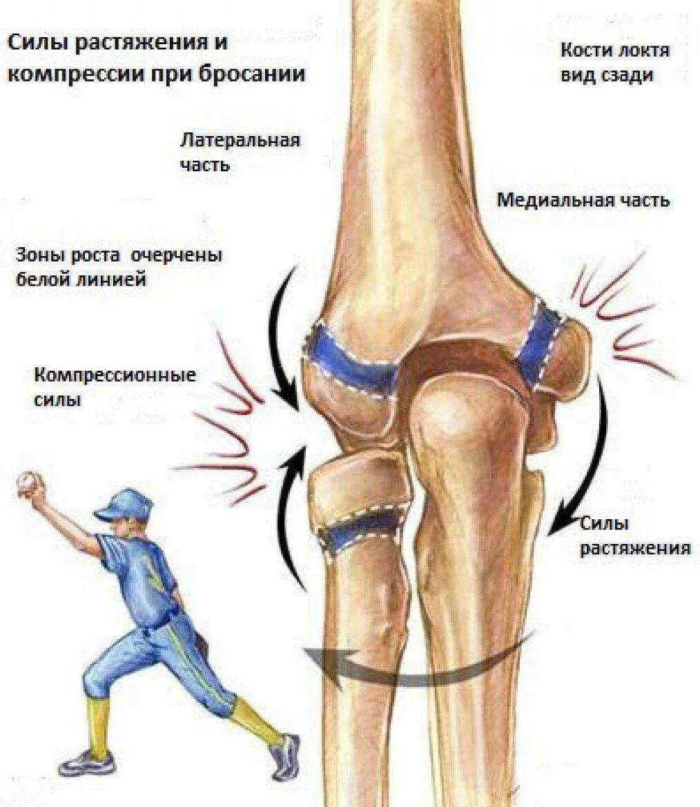 Связки локтя. Повреждение локтевого сустава. Растяжение капсульно-связочного аппарата локтевого сустава. Повреждение связок при вывихе локтевого сустава. Разрыв связок локтевого сустава.