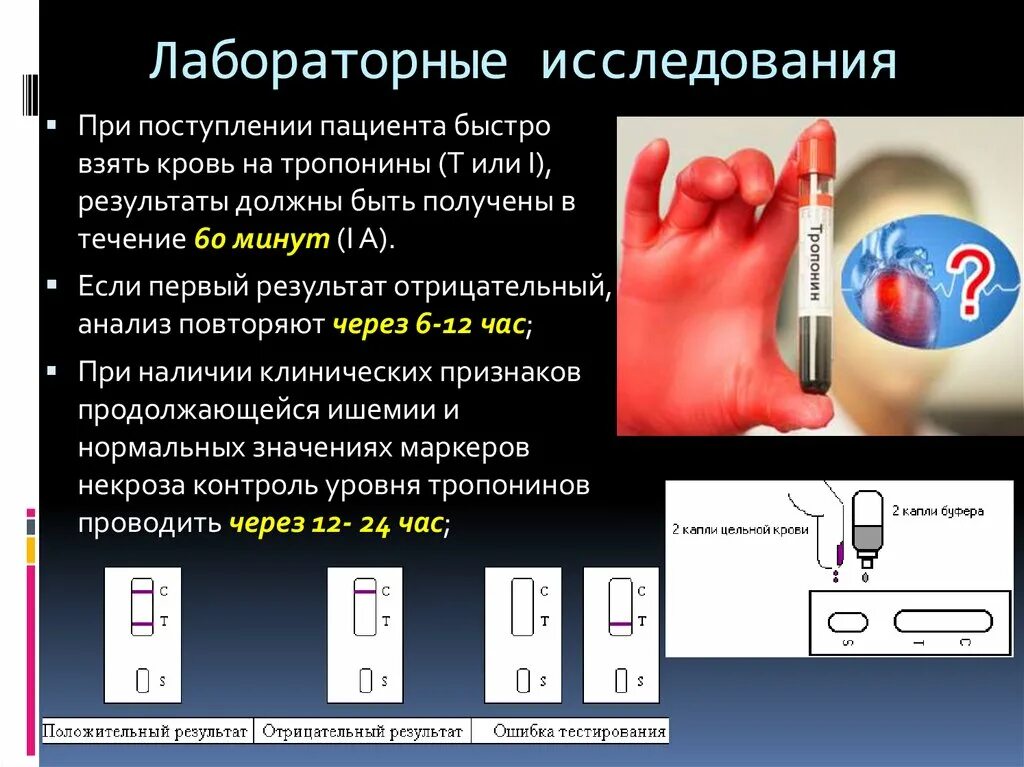 Тест на манипуляцию. Исследование уровня тропонина в крови. Тропониновый тест. Экспресс тест на тропонин. Лабораторные исследования при Окс.