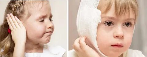 Отит компресс на ухо ребенку