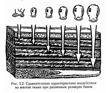 Действие банок