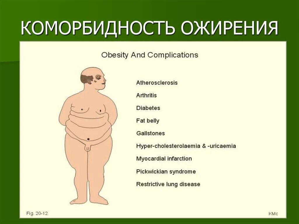 Ожирение. Коморбидность. Коморбидность ожирения. Морбидное морбидное ожирение. Коморбидный пациент это