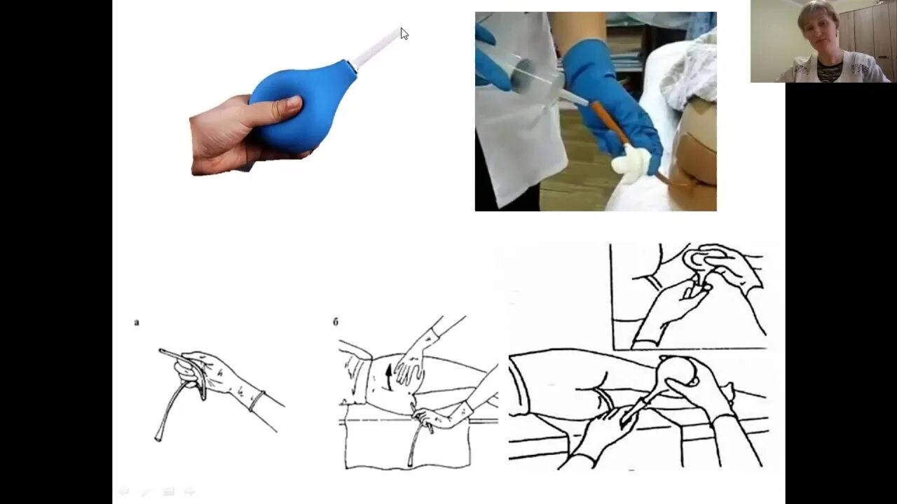 Выполнение очистительной клизмы. Технология постановки гипертонической клизмы. Постановка газоотводной клизмы алгоритм. Масляная послабляющая клизма оснащение. Гипертоническая клизма алгоритм.