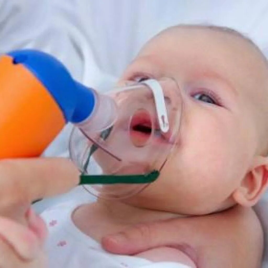 Доктор мол пластины для ингаляции новорождённым. Ребенок в кислородной маске. Небулайзер для малышей. Можно ли ингаляции грудничкам. Ингаляция небулайзером физраствором для детей.