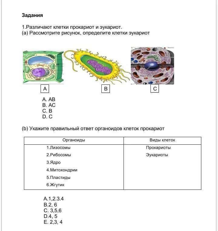 Прокариоты и эукариоты 9 класс биология. Рисунок прокариотической и эукариотической клетки. Прокариотическая и эукариотическая клетка. Органоиды клетки прокариот.