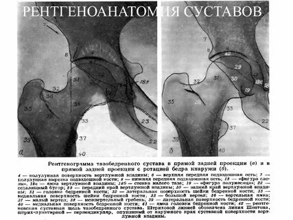Ширина суставная щель тазобедренного сустава