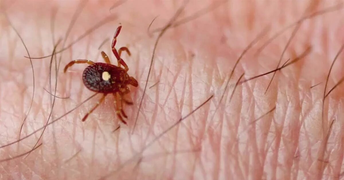 Tick bite make you allergic to