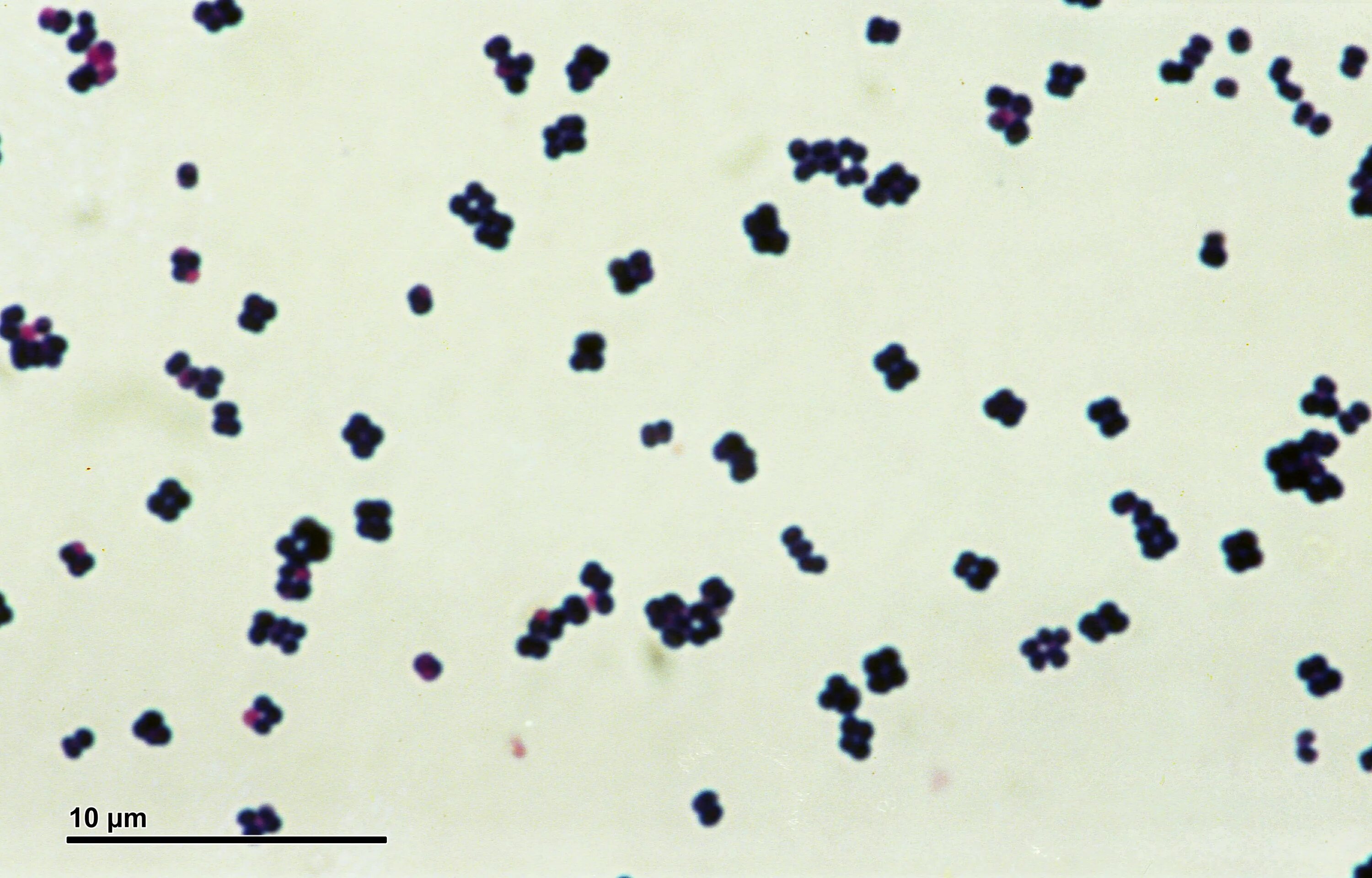 Streptococcus в мазке у мужчин. Micrococcus luteus микроскоп. Микрококки Лютеус. Micrococcus luteus препарат. Грамположительные кокки. Микрококки..