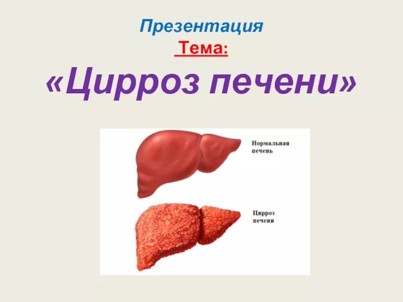 Цирроз печени презентация. Цирроз печени картинки для презентации. Цирроз печени фон для презентации.