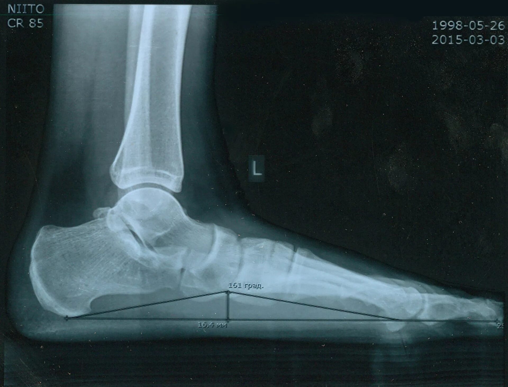 снимок скелета. карточка рентген. шейный отдел позвоночника рентген анатомия. сколиоз 2 степени рентген. мрт в формате dicom что это такое.