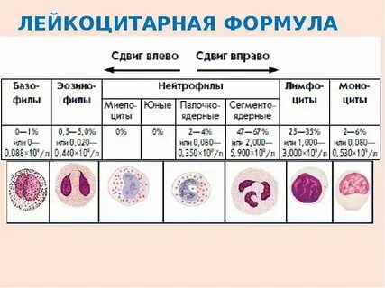 Как снизить уровень лейкоцитов