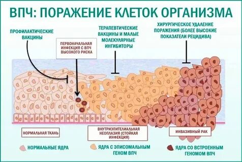 Откуда берется вирус папилломы у женщин