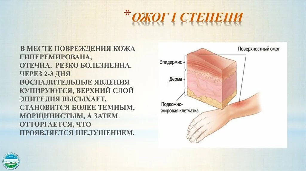 Заживший ожог 3 степени. Заболевания и повреждения кожи