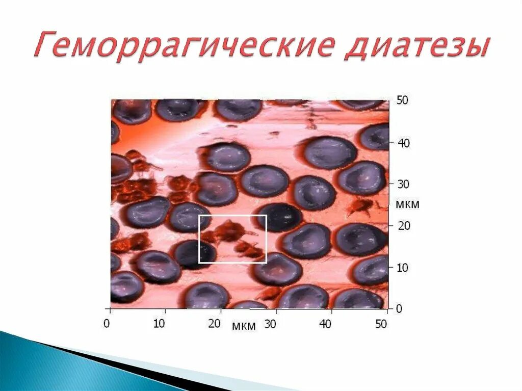 Геморрагические диатезы заболевания. Геморрагические диатезы. Геморрагический диатез. Геморрагический диатез у животных. Геморрагический диатез проявления.