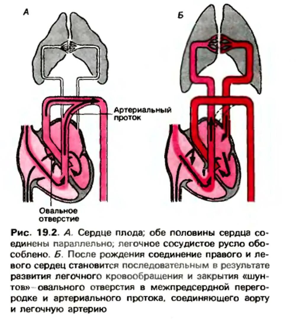 Окно в сердце у ребенка. Незаращение овального окна в сердце. Врождённый порок сердца незаращение овального отверстия. Овальное отверстие в сердце плода. Незаращение овального окна у детей.