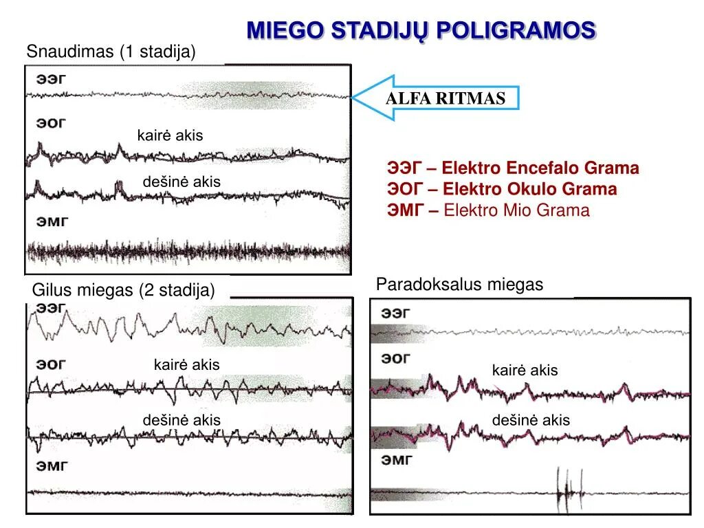 Ээг сигнал. ЭКГ ЭЭГ ЭМГ. ЭЭГ ЭОГ ЭМГ. Альфа ритм ЭЭГ. ЭКГ ЭЭГ расшифровка.