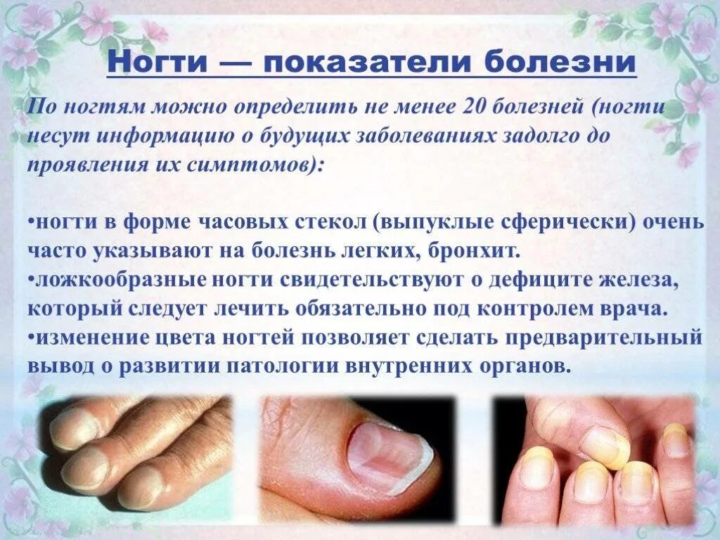 Почему плохо отделяются