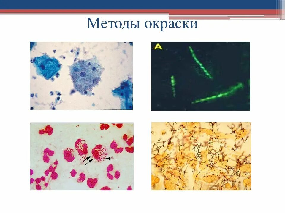 Окраска спор бактерий. Сложный метод окрашивания бактерий. Методы окраски бактериальной клетки. Методы окрашивания микроорганизмов микробиология. Сложный метод окраски микробиология.