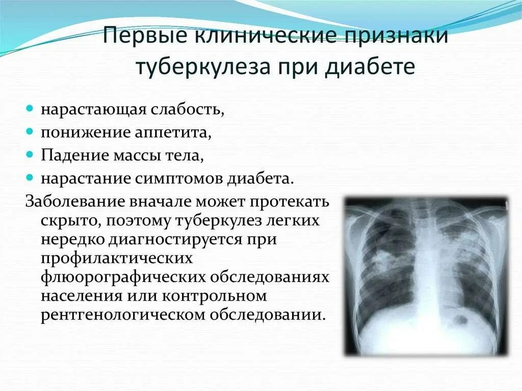 Как проявляется туберкулез симптомы