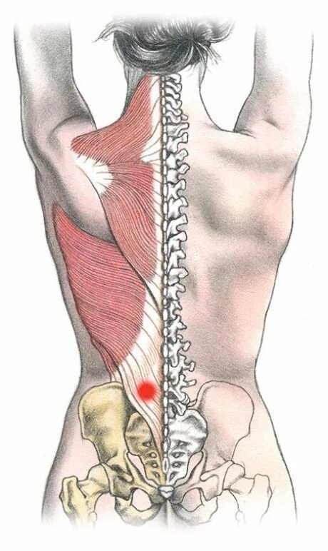 Боли низ поясницы. Мышцы пояснично-крестцового отдела позвоночника. Поясница. Мышцы поясницы и крестца. Болит поясница.