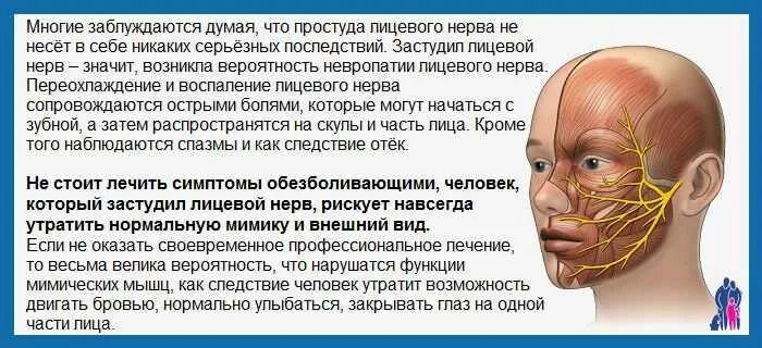 Лицевой нерв слева