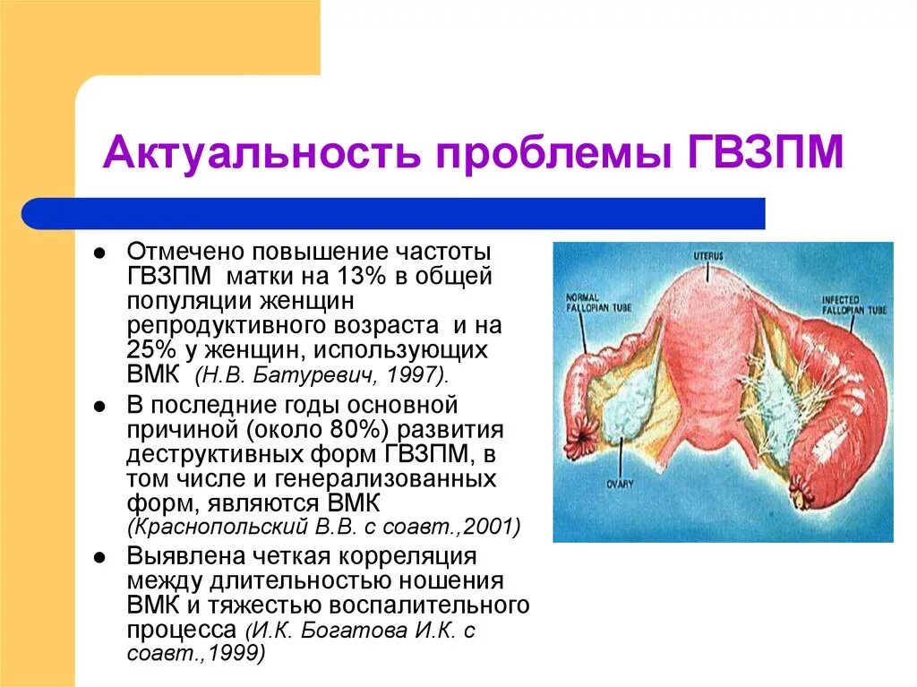 Придатки у мужчин симптомы. Заболевания матки презентация. Воспалительные процессы придатков матки презентация. Септический болезнь в матке. Гнойно-воспалительные заболевания придатков.