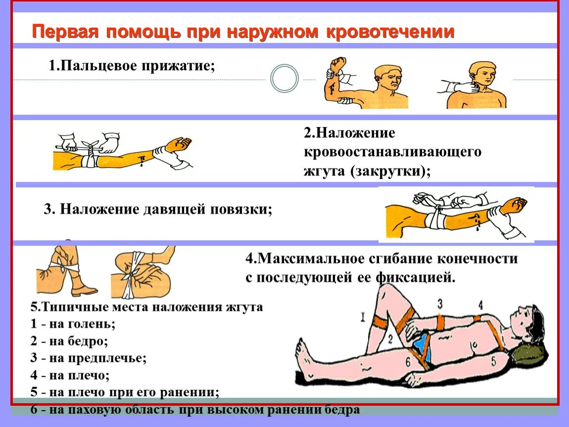 Первая помощь при кровотечениях 8 класс обж. Алгоритм оказания первой помощи при наружном кровотечении. Алгоритм оказания 1 помощи при наружном кровотечении. Последовательные этапы первой помощи при наружном кровотечении. Последовательности этапы первой помощи при наружном кровотечении..