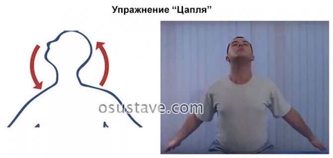 Зарядка шишонина от головокружения. Зарядка доктора шишонина для шейного отдела позвоночника. упражнения при шейном остеохондрозе доктора шишонина. упражнение цапля шишонина. комплекс шишонина для шеи.