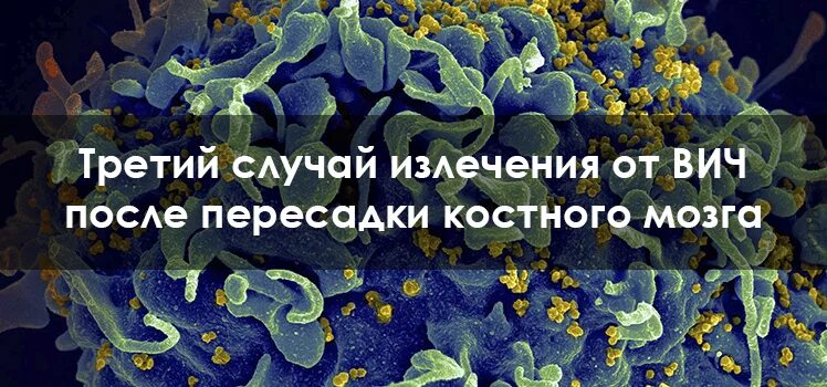 Вич полное излечение последние. ВИЧ полное излечение последние новости. ВИЧ полное излечение на сегодня последние новости.