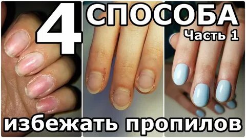 Пропили ногтей
