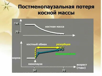 Костный обмен