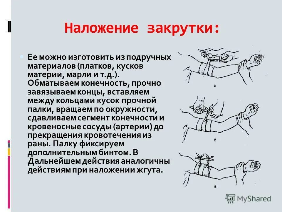 Артериальное кровотечение подручные средства. Наложение жгута-закрутки на плечо. Техника наложения жгута закрутки алгоритм. Наложить жгут закрутку. Наложение кровоостанавливающего жгута закрутки.